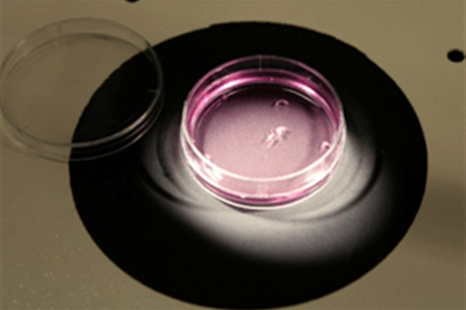 Male infertility: Sperm Quality and IVF Treatments | Seng