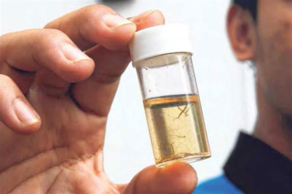 What you need to know about Zika | Seng