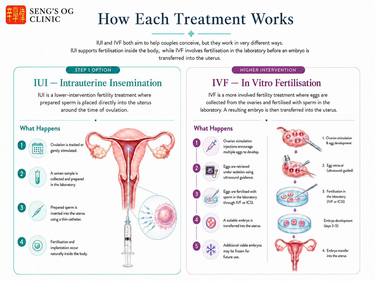 How IUI and IVF work