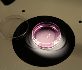 IUI vs IVF Treatments in Singapore: Which Treatment is Right for You?