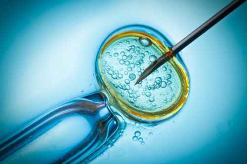 Intracytoplasmic Sperm Injection (ICSI), gynaecology in Singapore, Singapore Gynaecology