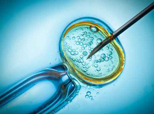 IUI vs IVF Treatments in Singapore: Which Treatment is Right for You?