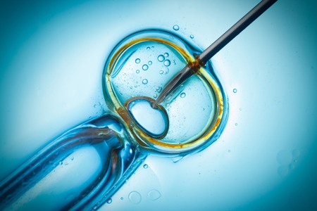 IUI vs IVF Treatments in Singapore: Which Treatment is Right for You?