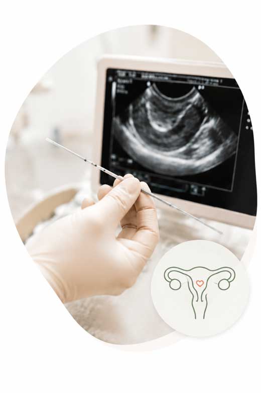 Embryo transfer catheter with ultrasound guidance
