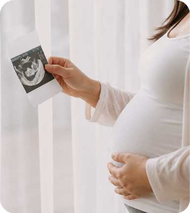 Pregnant woman holding an ultrasound scan