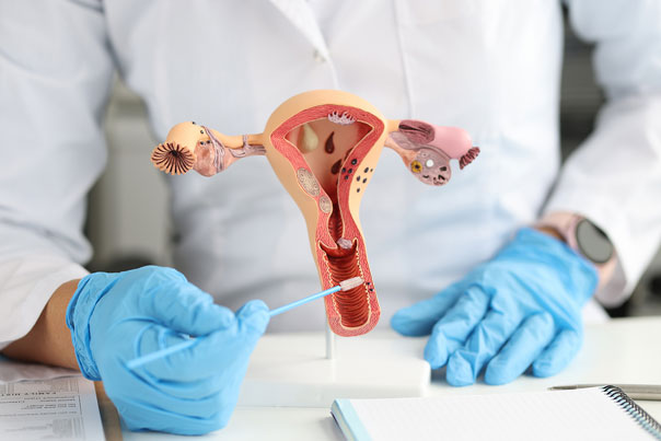 Doctor reviewing endometrial biopsy results and treatment recommendations